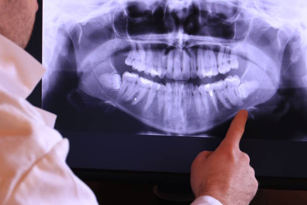 Best 24-Hour Emergency Dentist in Frisco, TX