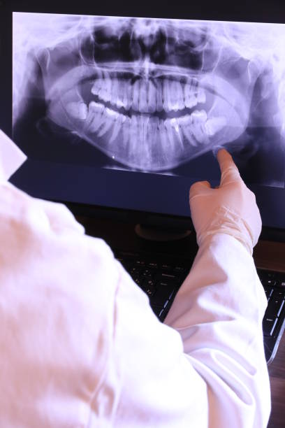 Best Emergency Treatment for Dental Infections or Abscesses in Frisco, TX